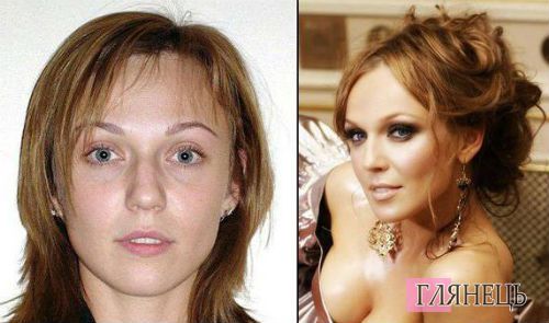 Жена Меладзе Джанабаева сделала пластику - фото до и после | РБК Украина